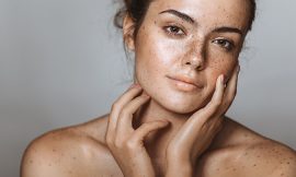 What are the new treatments for melasma?