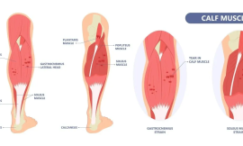 Comprehensive Guide to Healing Muscle Injuries: Treatment and Prevention Strategies from Progressive Specialists’ Experts