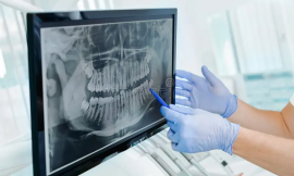 How Dental Panoramic X-Rays Help Detect Hidden Issues in Dubai Patients