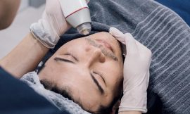 Fractional RF Microneedling for Full Face Rejuvenation in Dubai