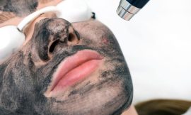 Carbon Laser Peel A Gentle Yet Powerful Skin Solution