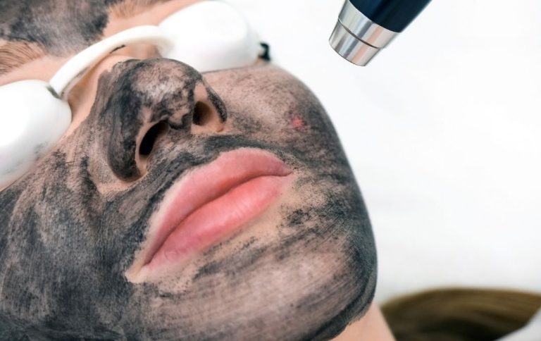 Read more about the article Carbon Laser Peel A Gentle Yet Powerful Skin Solution