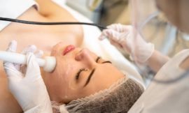 5 Benefits of Radio Frequency Skin Tightening You Need to Know