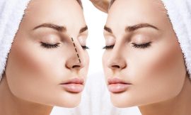 Rhinoplasty Recovery in Dubai Tips for a Smooth Healing Process