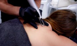 Are there any financing options for tattoo removal in Dubai?