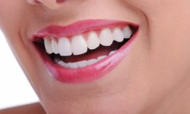 Explore Affordable Teeth Whitening Services in Dubai