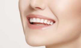 Teeth Whitening in Dubai: What You Need to Know