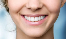 Transform Your Smile: Teeth Whitening Solutions in Dubai