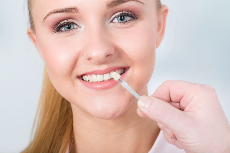 Read more about the article Transform your teeth with cosmetic dentistry in Dubai