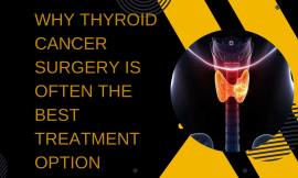 Why Thyroid Cancer Surgery Is Often the Best Treatment Option