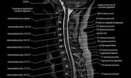 Educational Tools and Resources for Learning CT Head and Neck Sagittal Labeling