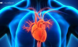 Global Cardiometabolic Disease Market Size, Share, Trends, Key Players, & Growth Outlook | 2025 – 2034