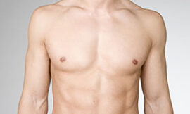 Non-Surgical Solutions for Gynecomastia: Are They Effective?