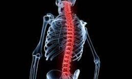 Spinal Cord Injuries in Dubai: The Importance of Early Intervention