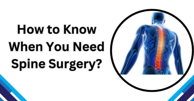 Read more about the article How to Know When You Need Spine Surgery?