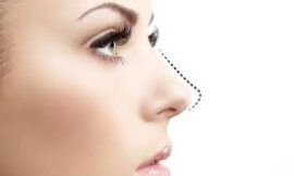 What to Expect During Rhinoplasty Surgery in Dubai: A Complete Overview