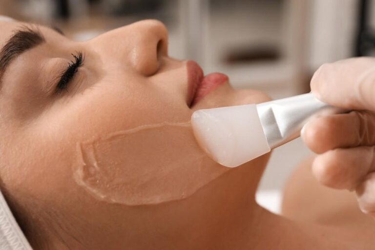 Read more about the article How Much Does a Chemical Peel Cost for Acne Scars?