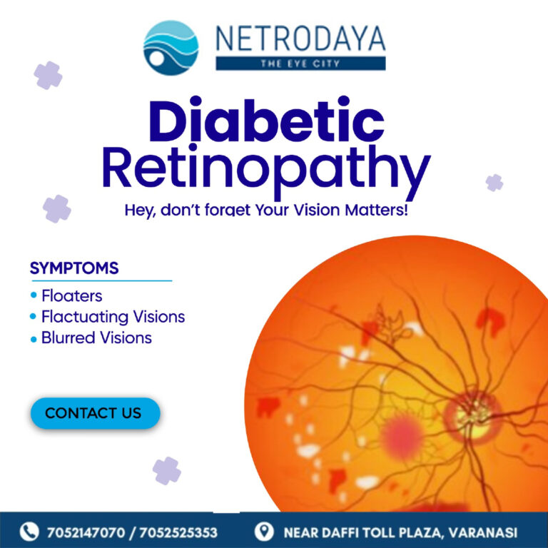 Read more about the article Best Retina Hospital in Varanasi & Best Glaucoma Hospital in Varanasi – Netrodaya Hospital