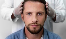 Scalp Micropigmentation as a Transformative Thinning Hair Solution