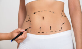 Bariatric Surgery and Skin Changes Dealing with Excess Skin After Weight Loss