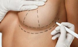 Common Myths About Breast Augmentation You Shouldn’t Believe