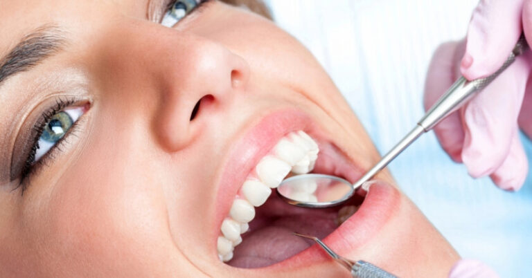 Read more about the article Full Mouth Restoration, A Comprehensive Solution for Every Smile