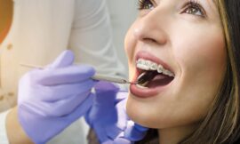 How General Dentistry Helps with Gum Disease Prevention