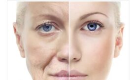 Mexico Anti-Aging Market Size, Share, Trends and Forecast 2024-2032