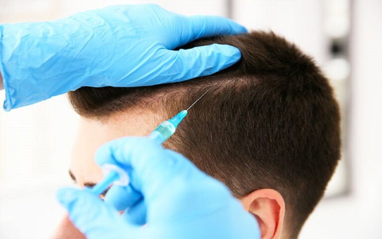 Read more about the article How PRP Hair Treatment Stimulates Dormant Follicles