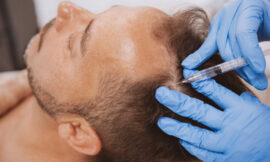 Where To Get A Quick Hair Transplant Consultation