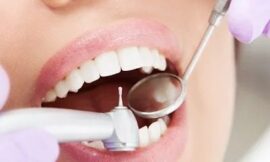 The Cost of Preventing Tooth Decay Dental Fillings in Dubai Explained