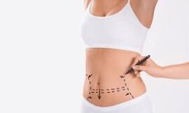 The Risks and Safety Standards of Lipo Abdominoplasty in Dubai: What You Need to Know