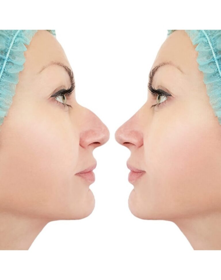 Read more about the article What Makes Dubai a Leading Hub for Rhinoplasty Procedures