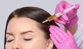 What to Expect During a Platelet Rich Plasma Hair Treatment in Dubai