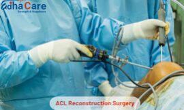 Understanding ACL Reconstruction Surgery: Cost, Recovery, and Success