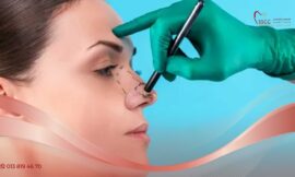 What to Expect During Rhinoplasty Surgery in Riyadh