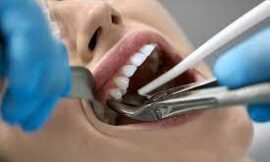 Is Tooth Extraction Painful, Myths vs. Facts