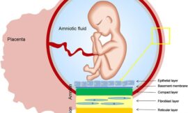 Amniotic Membrane Market: Trends, Growth Drivers, and Future Outlook