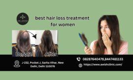 Best Hair Loss Treatment for women Including prevention and causes