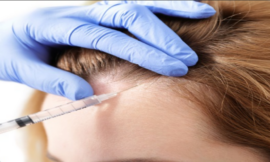 What to Expect During a PRP Hair Treatment Session