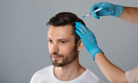 Understanding FUE Hair Transplant Procedure