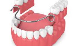 Restore Your Smile with High-Quality Dentures