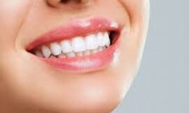 Experience Fast Results with Nano Teeth Whitening