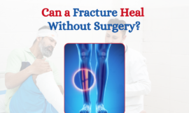 Can a Fracture Heal Without Surgery?