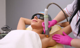 The Gold Standard in Hair Removal – Electrolysis in Dubai