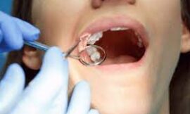 How Wisdom Teeth Extraction Can Improve Jaw Health