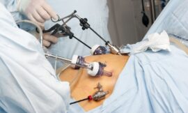 The Future of Personalized Bariatric Surgery in Dubai