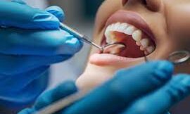 All About General Dentistry and What It Covers