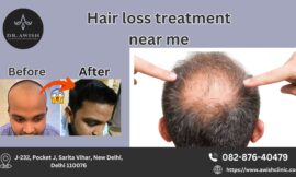 Hair Loss Treatment Near Me Effective Solutions for Thicker, Healthier Hair