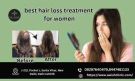 Best Hair Loss Treatment for women Including prevention and causes